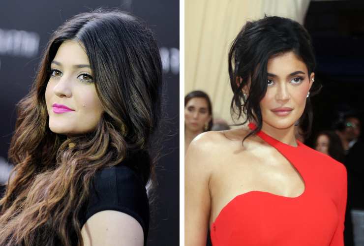 Kylie Jenner da adolescente ed oggi